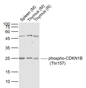 Phospho-CDKN1B (Thr157) Rabbit Polyclonal Antibody