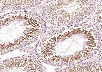MEK5 Rabbit Polyclonal Antibody