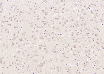 MEK5 Rabbit Polyclonal Antibody