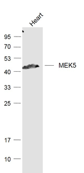 MEK5 Rabbit Polyclonal Antibody