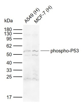 P53 (phospho-Ser15) antibody