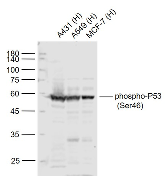 Phospho-P53 (Ser46) Rabbit Polyclonal Antibody