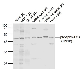 P53 (phospho-Thr18) antibody
