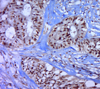 Phospho-P53 (Thr55) Rabbit Polyclonal Antibody