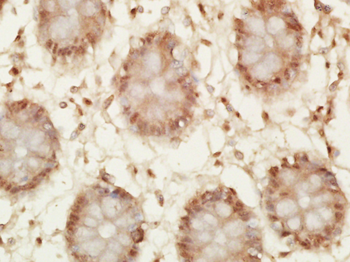 Phospho-P53 (Thr55) Rabbit Polyclonal Antibody