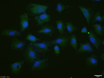 P53 (phospho-Thr55) antibody