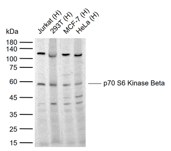 P70 S6 Kinase Beta Rabbit Polyclonal Antibody
