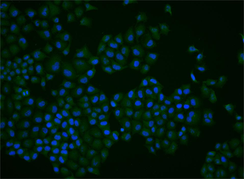 PABP Rabbit Polyclonal Antibody