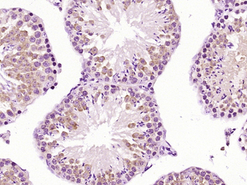 PABP Rabbit Polyclonal Antibody