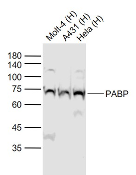 PABP Rabbit Polyclonal Antibody