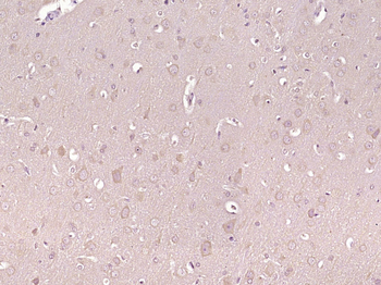 Phospho-PAK1 (Thr212) Rabbit Polyclonal Antibody