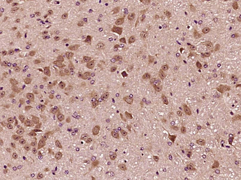 PAK6 Rabbit Polyclonal Antibody