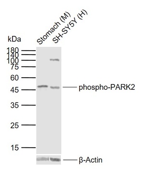 Parkin (phospho-Ser378) antibody