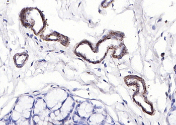 Phospho-Paxillin (Tyr88) Rabbit Polyclonal Antibody