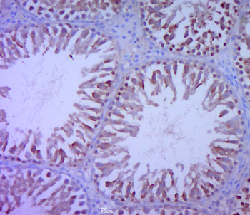 Phospho-Paxillin (Tyr88) Rabbit Polyclonal Antibody