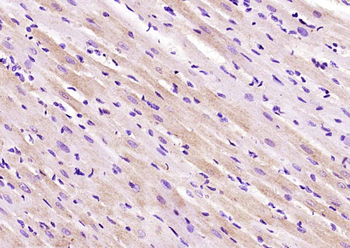 PDE5A Rabbit Polyclonal Antibody