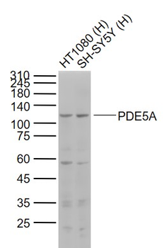PDE5A Rabbit Polyclonal Antibody