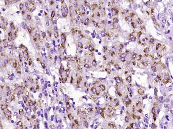 Thymidine phosphorylase Rabbit Polyclonal Antibody