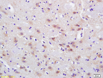 PDK2 Rabbit Polyclonal Antibody