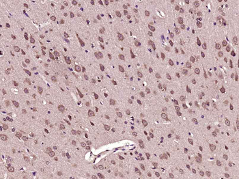 PFKFB3/PFK2 Rabbit Polyclonal Antibody
