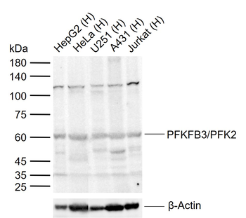 PFKFB3/PFK2 Rabbit Polyclonal Antibody
