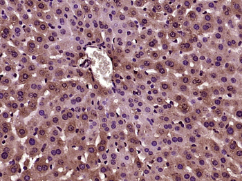 PFKFB1 Rabbit Polyclonal Antibody