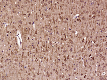 PFKFB2/PFK2 Rabbit Polyclonal Antibody