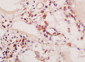 Phospho-PIK3C3 (Ser164) Rabbit Polyclonal Antibody