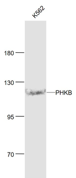 PHKB Rabbit Polyclonal Antibody