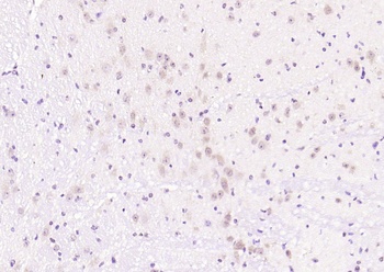 PI3K p85 (phospho-Tyr368) antibody