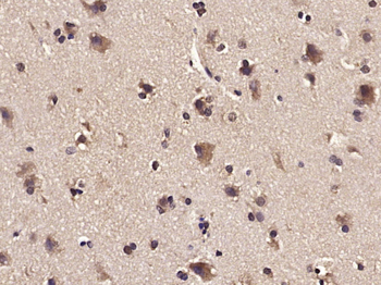 PIK3R2 Rabbit Polyclonal Antibody