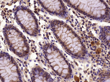 PIK3R2 Rabbit Polyclonal Antibody