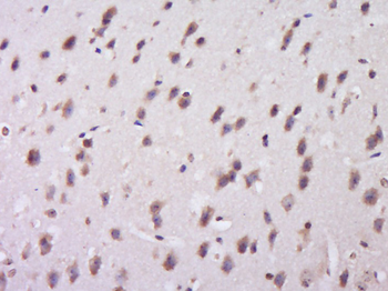 PIK3R2 Rabbit Polyclonal Antibody
