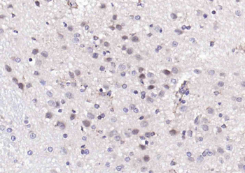 PIK3R2 Rabbit Polyclonal Antibody
