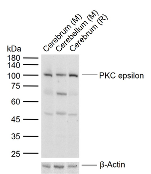 PKC epsilon Rabbit Polyclonal Antibody