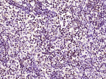Phospho-PKC delta (Tyr311) Rabbit Polyclonal Antibody