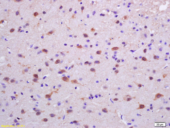 Phospho-PKC delta (Tyr311) Rabbit Polyclonal Antibody