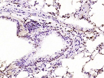PKC delta (phospho-Tyr311) antibody