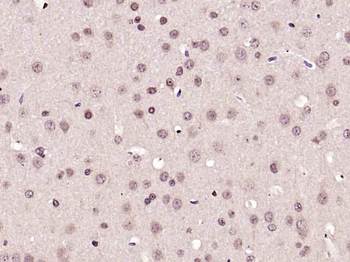 Phospho-PRKCB (Thr642) Rabbit Polyclonal Antibody
