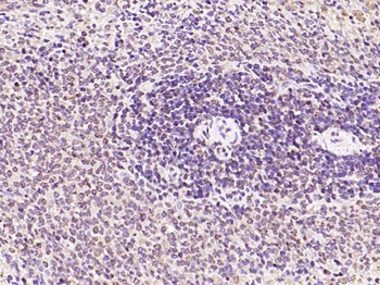 Phospho-PRKCB (Thr642) Rabbit Polyclonal Antibody