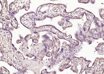 PLK1 Rabbit Polyclonal Antibody