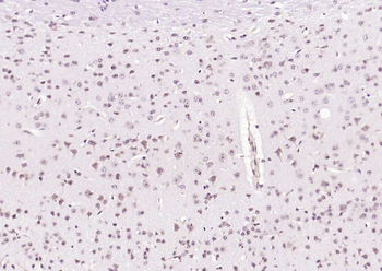 PLK1 Rabbit Polyclonal Antibody