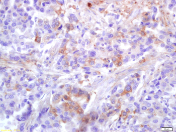 Phospho-PLK1 (Thr210) Rabbit Polyclonal Antibody