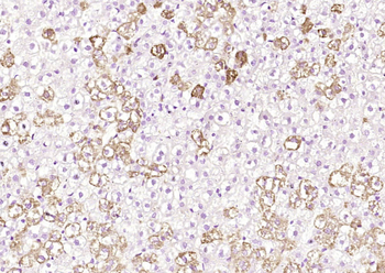 PNMT Rabbit Polyclonal Antibody