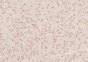 PNPO Rabbit Polyclonal Antibody
