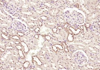 PNPO Rabbit Polyclonal Antibody