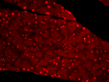 PP1C gamma Rabbit Polyclonal Antibody