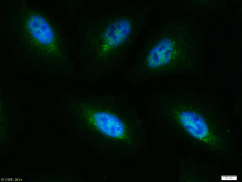Phospho-AKT1 + AKT2 + AKT3 (Thr308+Thr309+Thr305) Rabbit Polyclonal Antibody