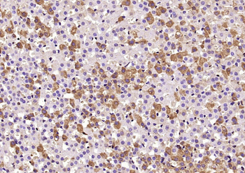 Seladin 1 Rabbit Polyclonal Antibody