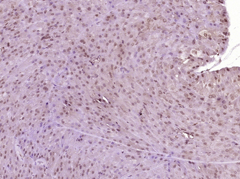 Phospho-AKT2 (Ser474) Rabbit Polyclonal Antibody